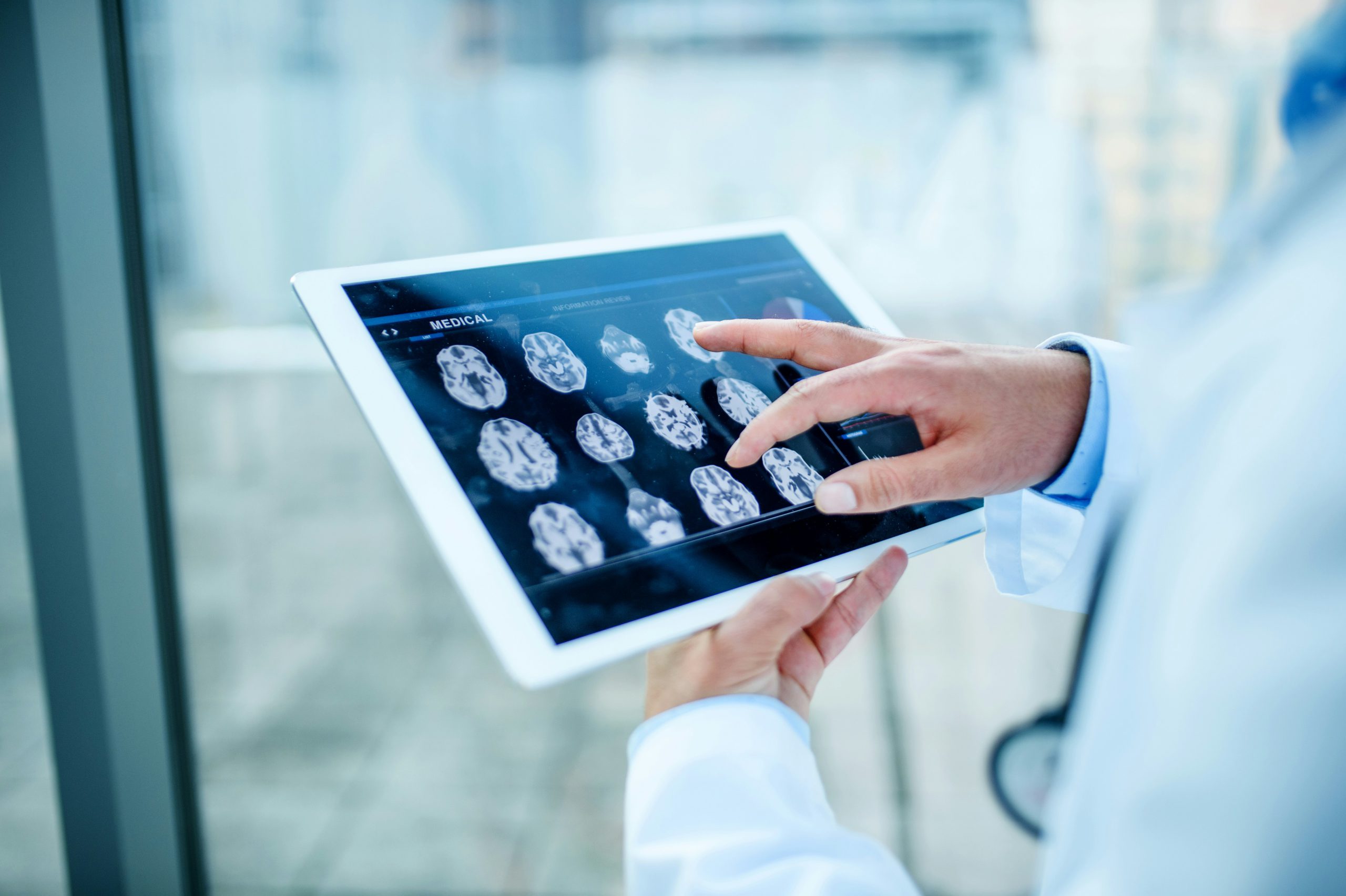 TMS and Brain Connectivity